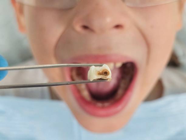 Best Urgent Dental Care for Toothaches in Tidmore Bend, AL